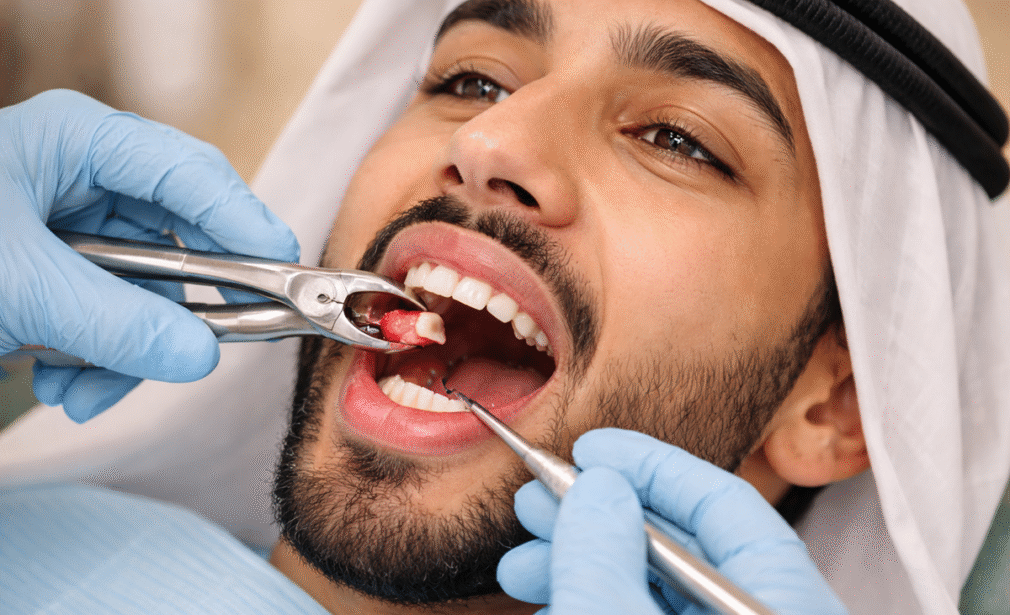 Tooth Removal Business Bay Dubai Cost
