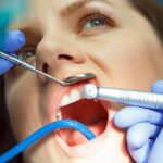 Exploring Restorative Dentistry Options in Dubai