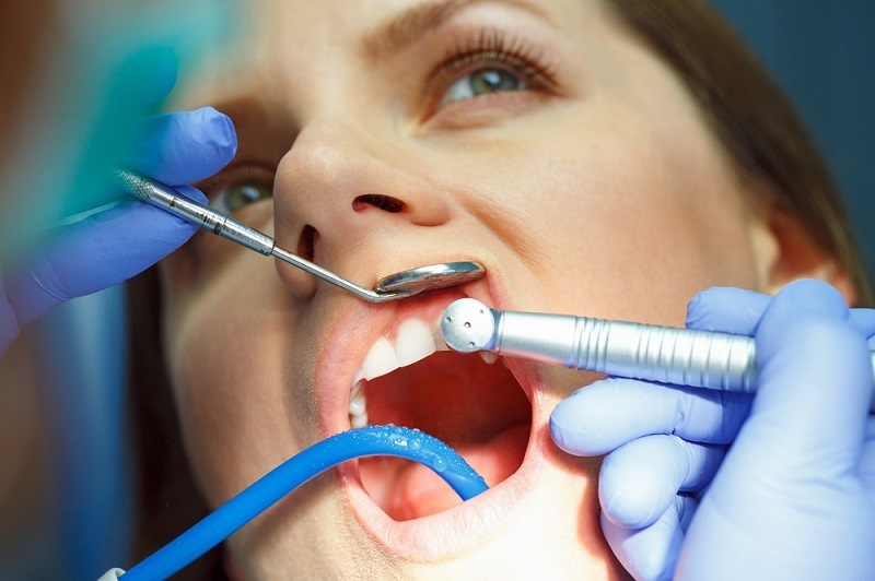 Exploring Restorative Dentistry Options in Dubai