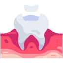 Dental Filling business bay dubai