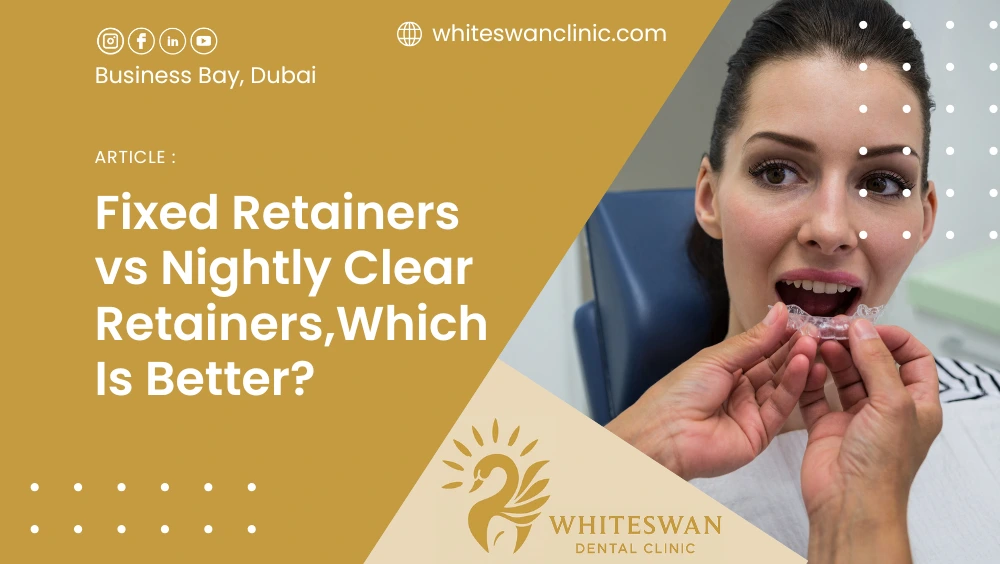 Fixed Retainers vs Nightly Clear Retainers,Which Is Better?