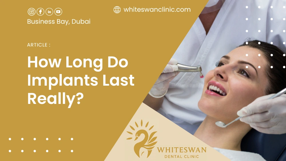 How Long Do Implants Last Really?