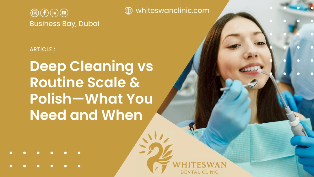 Deep Cleaning vs Routine Scale & Polish—What You Need and When