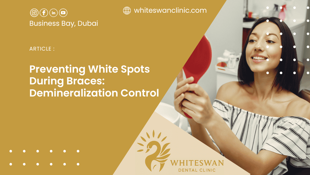 Preventing White Spots During Braces: Demineralization Control