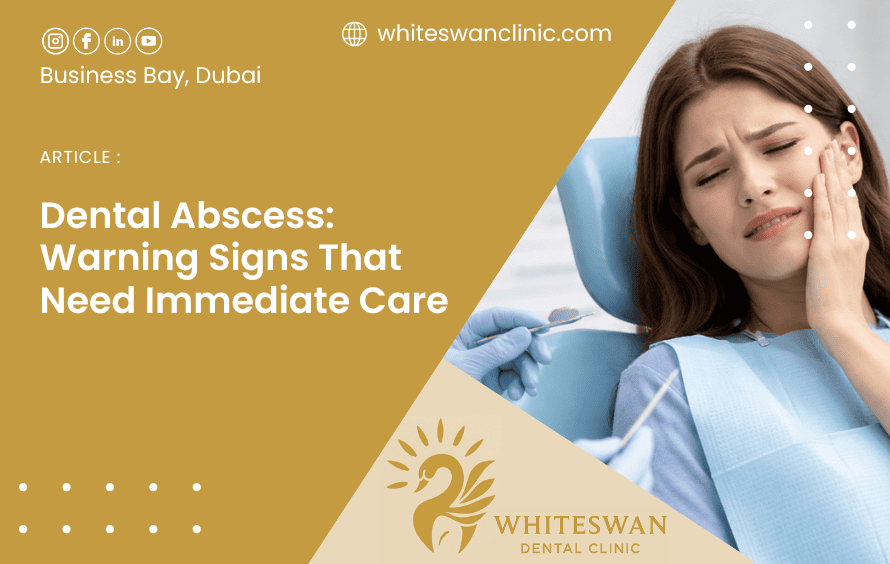Dental Abscess: Warning Signs That Need Immediate Care