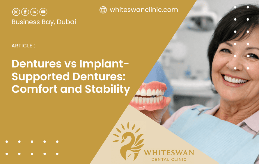 Dentures vs Implant-Supported Dentures: Comfort and Stability
