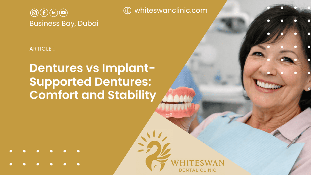 Dentures vs Implant-Supported Dentures: Comfort and Stability