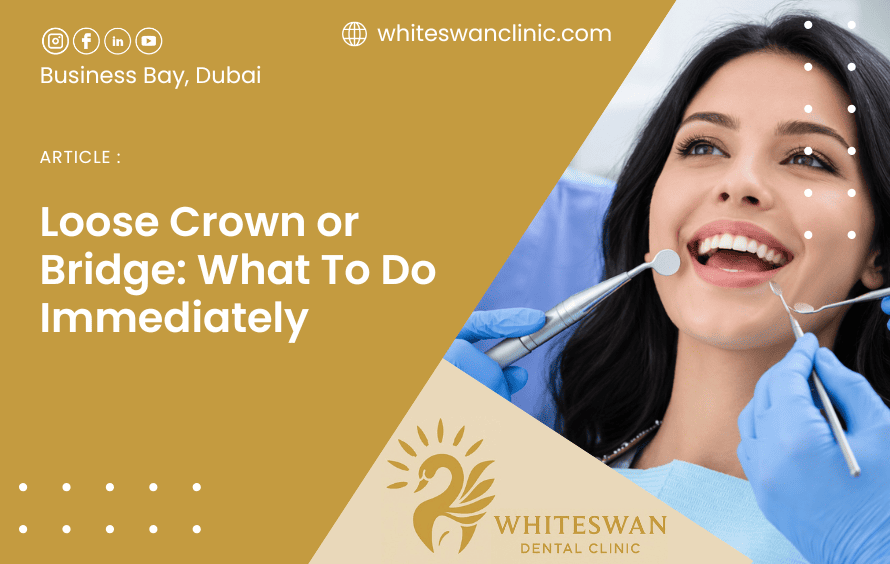 Loose Crown or Bridge: What To Do Immediately