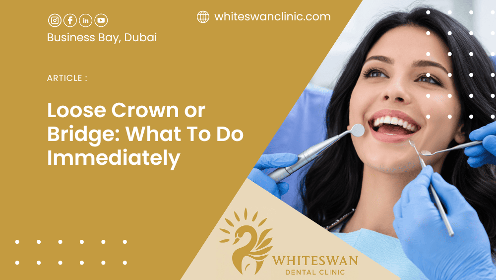 Loose Crown or Bridge: What To Do Immediately