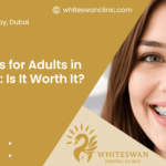 Braces for Adults in Dubai: Is It Worth It?