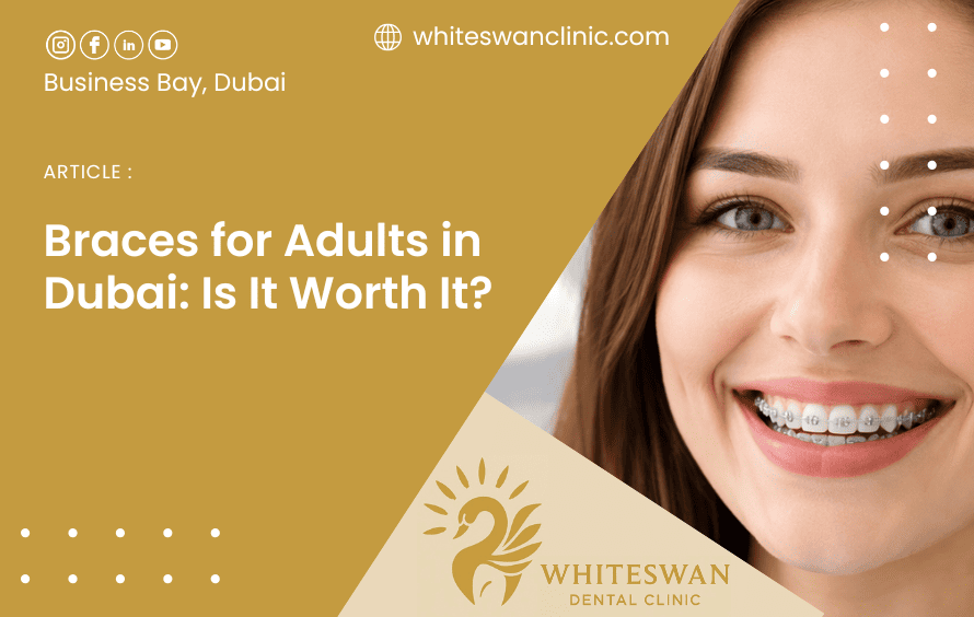 Braces for Adults in Dubai: Is It Worth It?