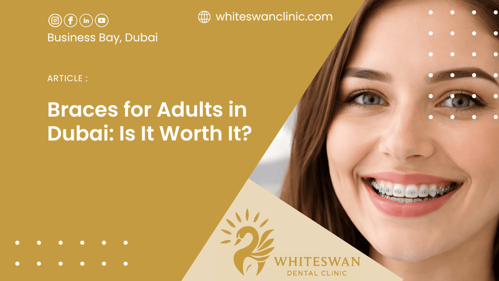 Braces for Adults in Dubai: Is It Worth It?