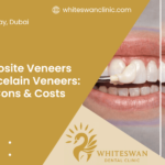 Composite Veneers vs Porcelain Veneers: Pros, Cons, Costs