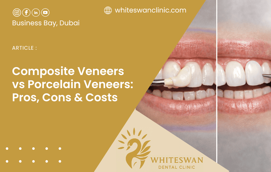 Composite Veneers vs Porcelain Veneers: Pros, Cons, Costs