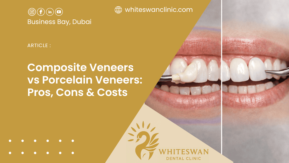 Composite Veneers vs Porcelain Veneers: Pros, Cons, Costs