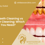 Deep Teeth Cleaning vs Regular Cleaning: Which One Do You Need?