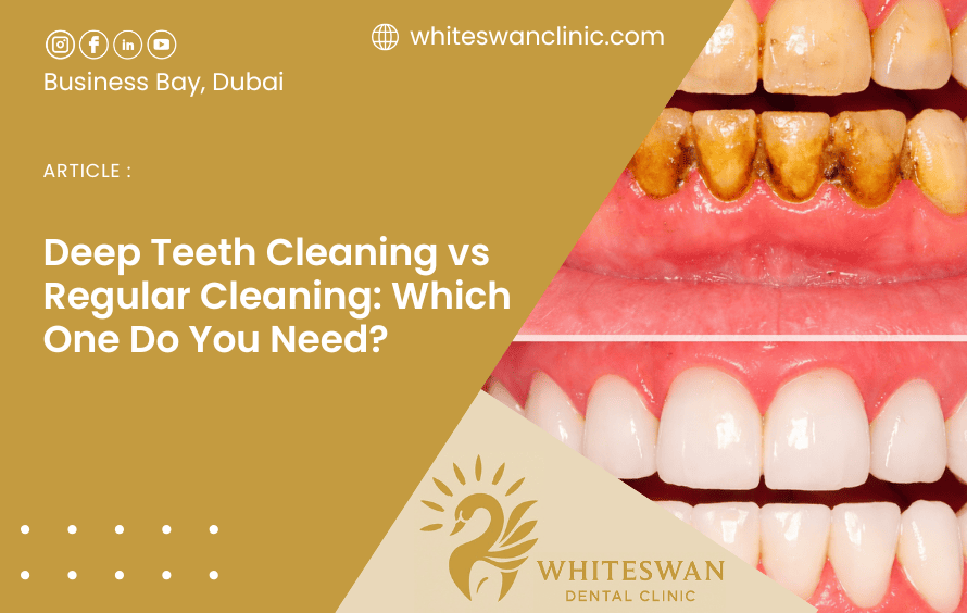 Deep Teeth Cleaning vs Regular Cleaning: Which One Do You Need?