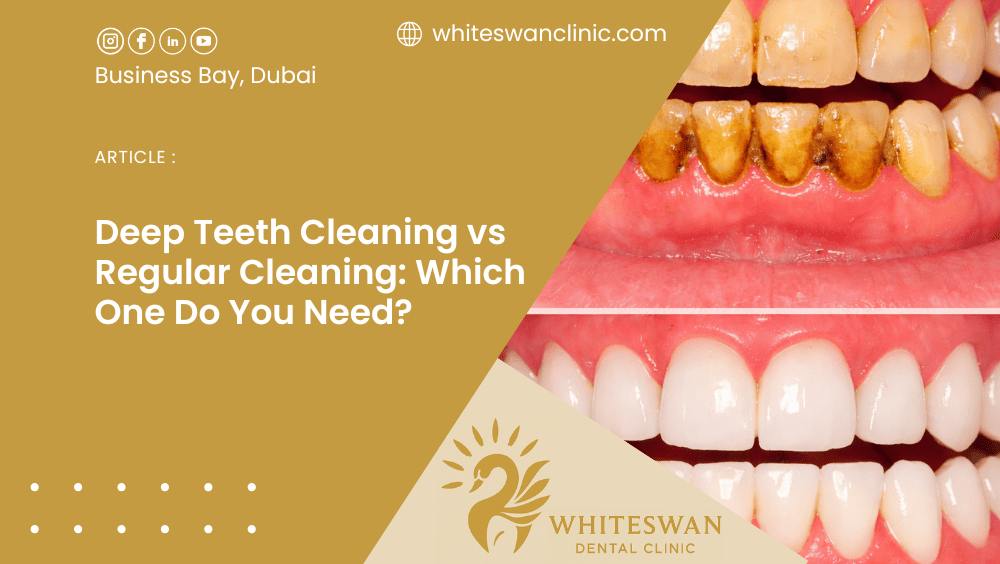 Deep Teeth Cleaning vs Regular Cleaning: Which One Do You Need?
