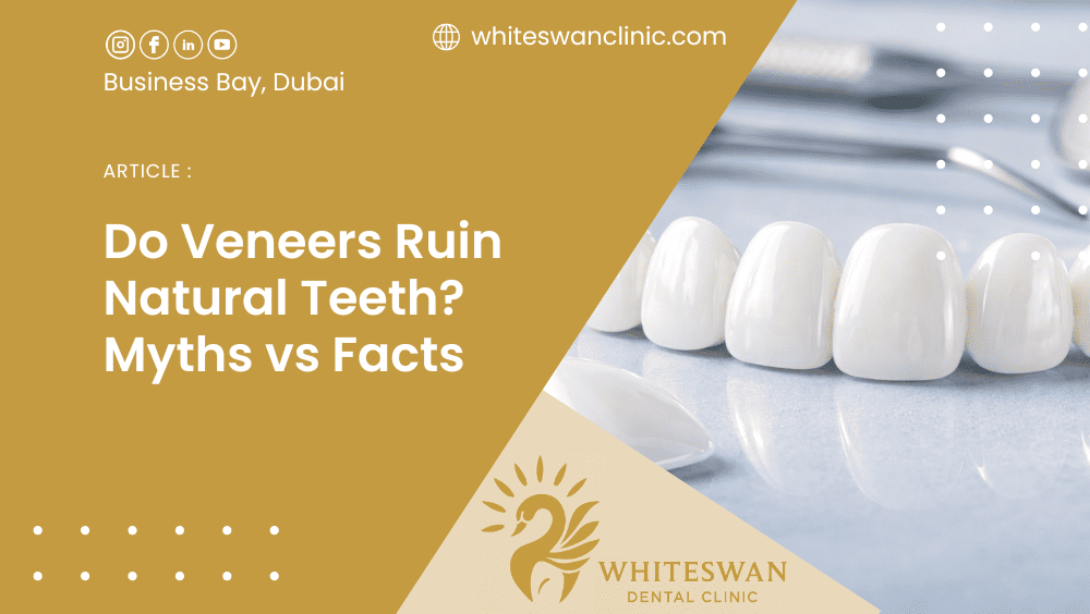 Do Veneers Ruin Natural Teeth? Myths vs Facts