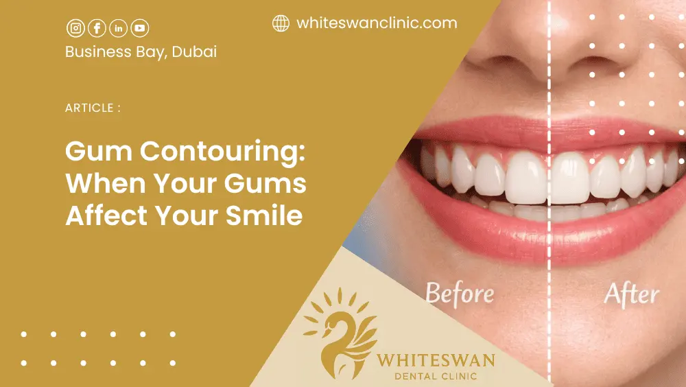 Gum Contouring: When Your Gums Affect Your Smile