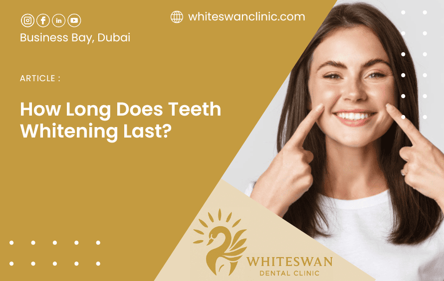 How Long Does Teeth Whitening Last?