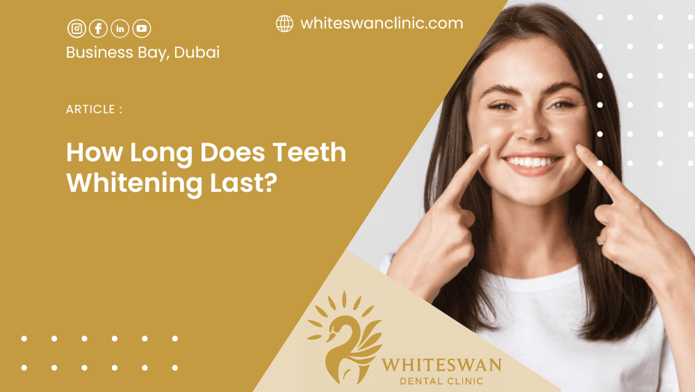 How Long Does Teeth Whitening Last?