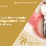 How to Care for Implants: A Cleaning Routine That Actually Works