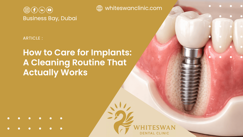 How to Care for Implants: A Cleaning Routine That Actually Works