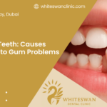 Loose Teeth: Causes Linked to Gum Problems