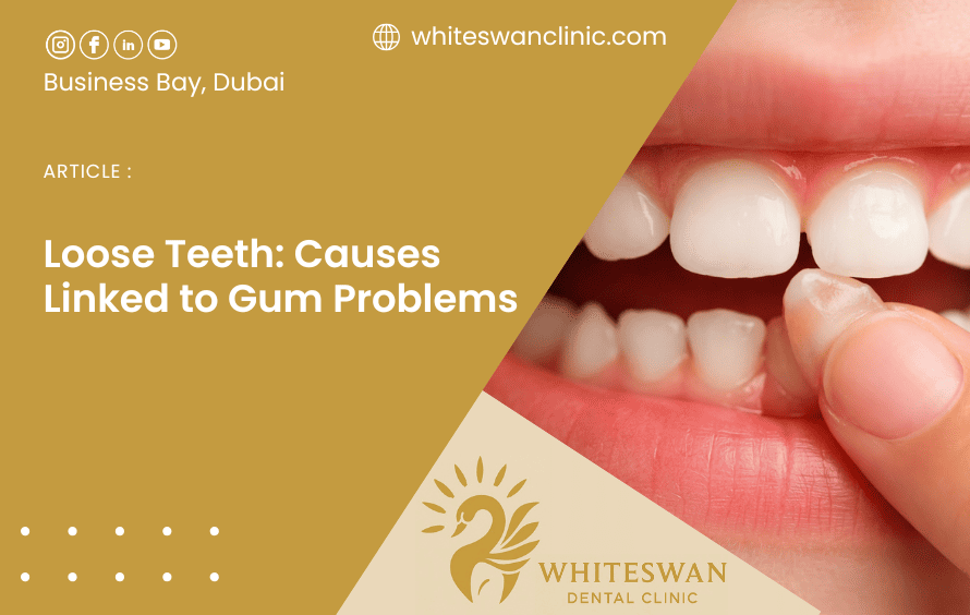 Loose Teeth: Causes Linked to Gum Problems