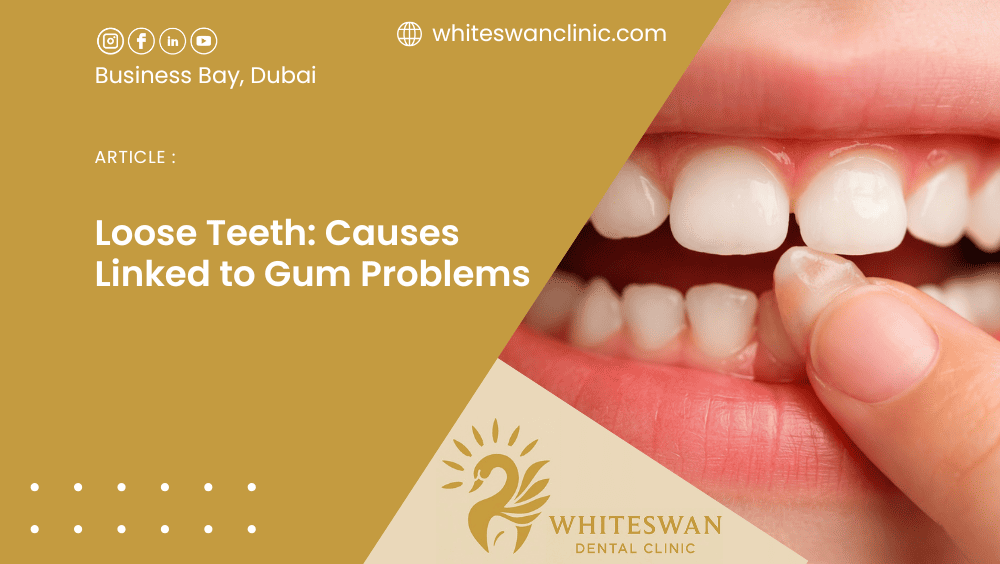 Loose Teeth: Causes Linked to Gum Problems