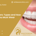 Retainers: Types and How Long You Must Wear