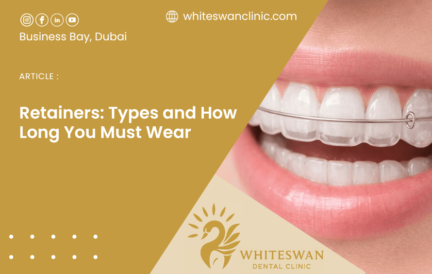 Retainers: Types and How Long You Must Wear