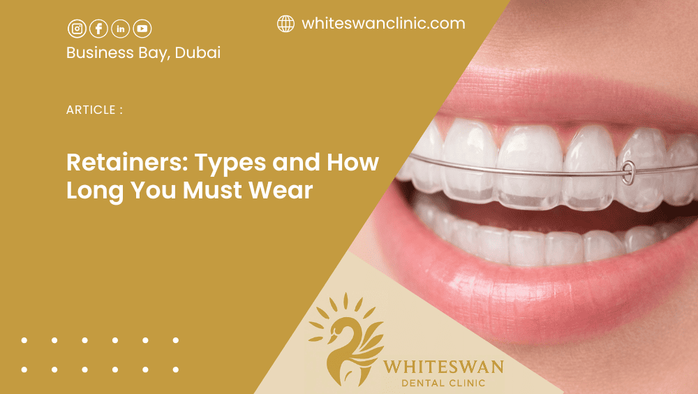 Retainers: Types and How Long You Must Wear