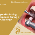 Scaling and Polishing: What Happens During a Dental Cleaning?