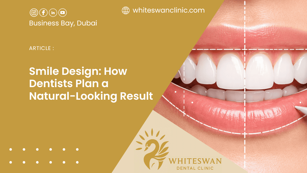 Smile Design: How Dentists Plan a Natural-Looking Result