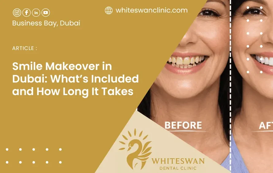 Smile Makeover in Dubai: What’s Included and How Long It Takes