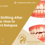 Teeth Shifting After Braces: How to Prevent Relapse