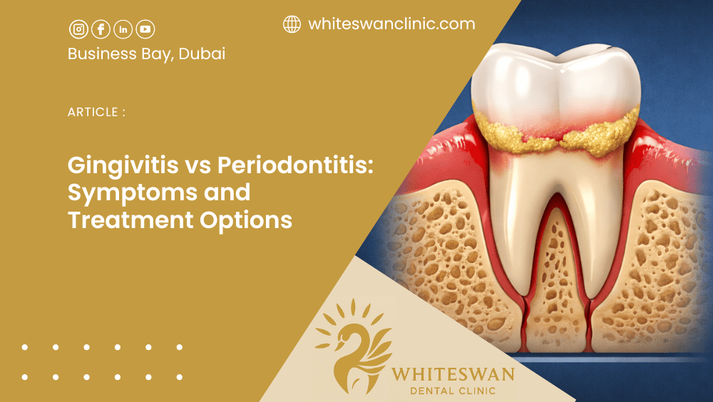 Gingivitis vs Periodontitis: Symptoms and Treatment Options