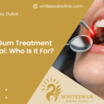 Laser Gum Treatment in Dubai: Who Is It For?