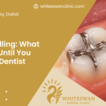 Lost Filling: What to Do Until You See a Dentist