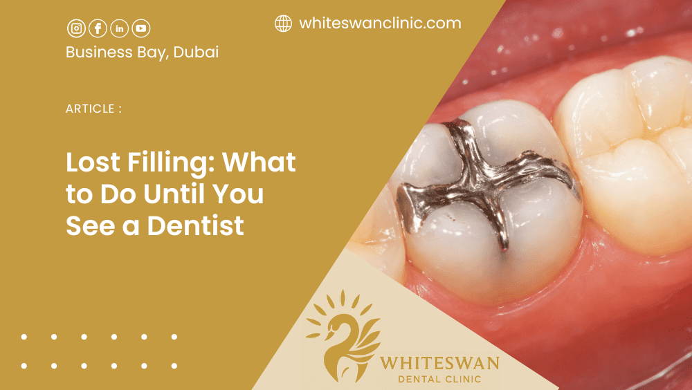Lost Filling: What to Do Until You See a Dentist