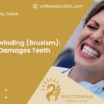 Night Grinding (Bruxism): How It Damages Teeth
