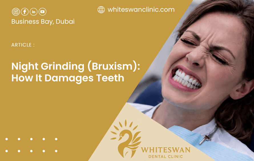 Night Grinding (Bruxism): How It Damages Teeth