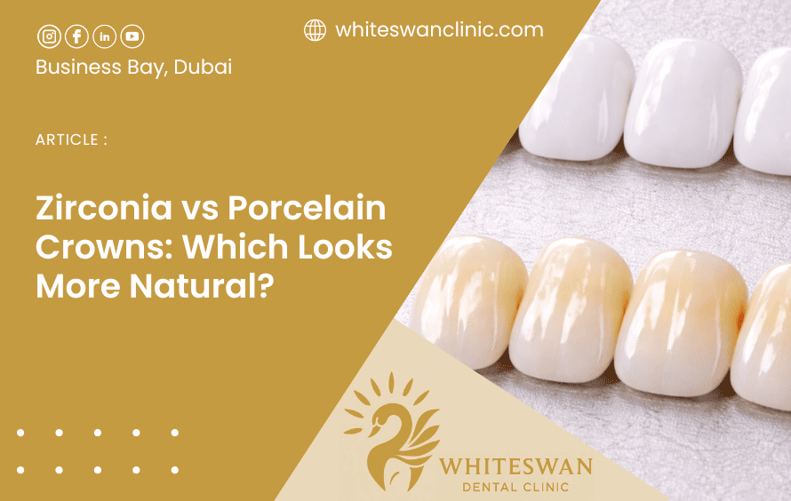 Zirconia vs Porcelain Crowns: Which Looks More Natural?