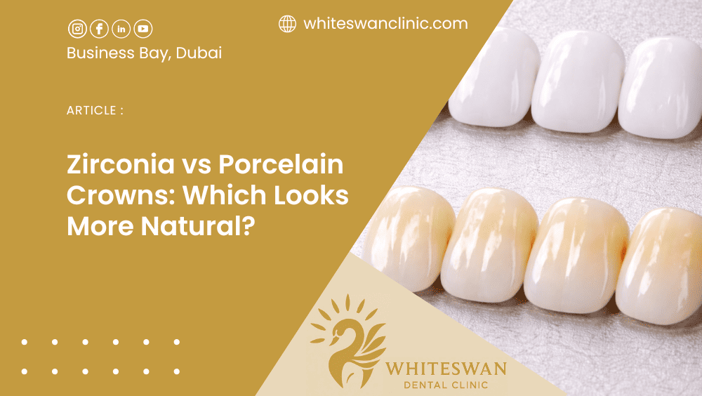 Zirconia vs Porcelain Crowns: Which Looks More Natural?